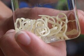 Паразиты в организме человека